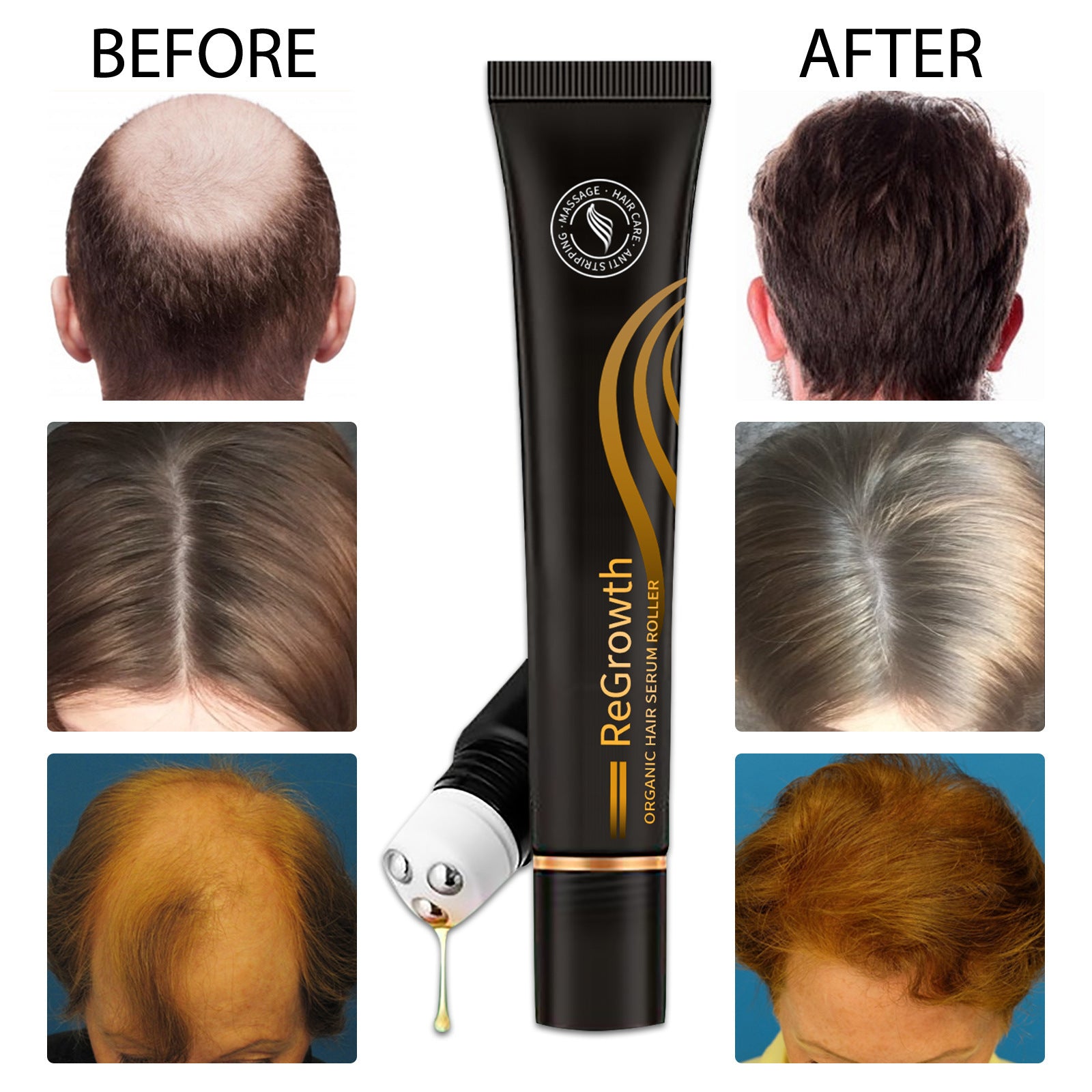 Regrowth Organic Hair Serum Roller Set Hair Care Anti Stripping Liquid Suitable For All Types Of Hair Loss Scalp Nourishing Regrowth Organic Hair Serum Roller Set Hair Care Anti Stripping Liquid Suitable For All Types Of Hair Loss Scalp Nourishing